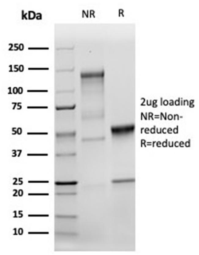 MSH2 Antibody in SDS-PAGE (SDS-PAGE)