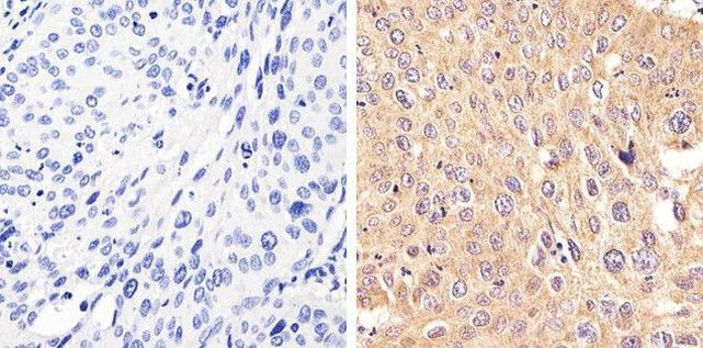 STAT2 Antibody in Immunohistochemistry (Paraffin) (IHC (P))