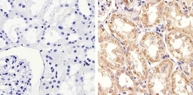 STAT2 Antibody in Immunohistochemistry (Paraffin) (IHC (P))