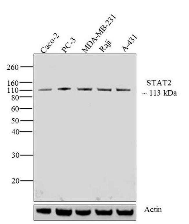 STAT2 Antibody in Western Blot (WB)