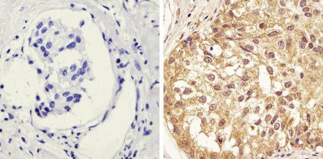 Phospho-STAT1 (Tyr701) Antibody in Immunohistochemistry (Paraffin) (IHC (P))