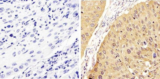 Phospho-STAT1 (Tyr701) Antibody in Immunohistochemistry (Paraffin) (IHC (P))