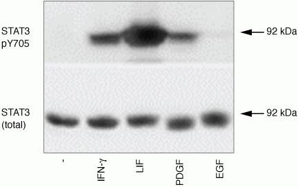 Phospho-STAT3 (Tyr705) Antibody in Western Blot (WB)