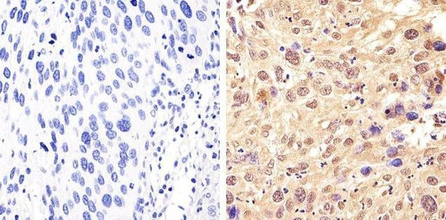 Phospho-STAT1 (Ser727) Antibody in Immunohistochemistry (Paraffin) (IHC (P))