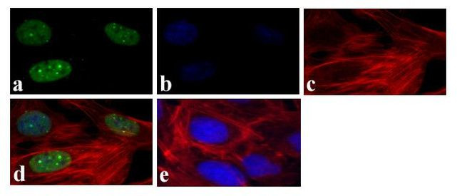 Phospho-STAT1 (Ser727) Antibody in Immunocytochemistry (ICC/IF)