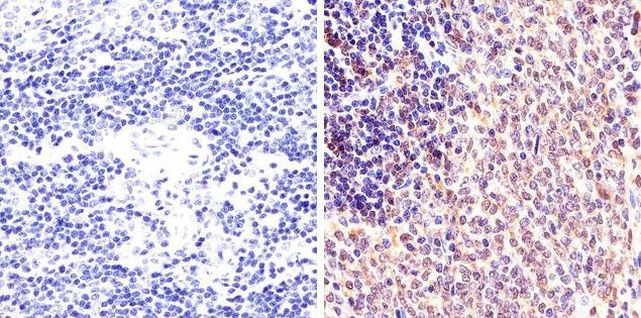 Phospho-STAT1 (Ser727) Antibody in Immunohistochemistry (Paraffin) (IHC (P))