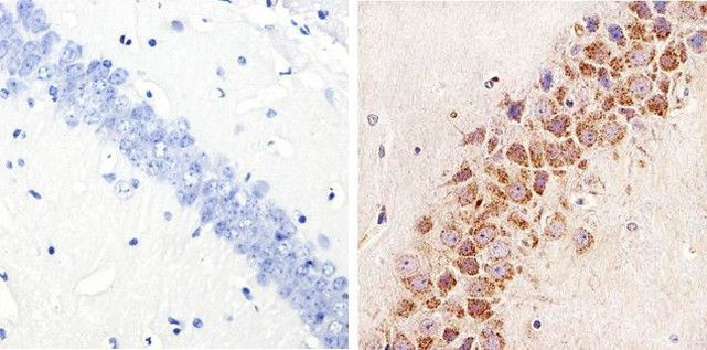 Phospho-STAT3 (Ser727) Antibody in Immunohistochemistry (Paraffin) (IHC (P))