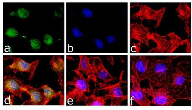 Phospho-STAT5 alpha (Tyr694) Antibody