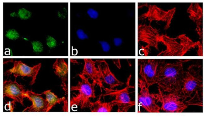 Phospho-STAT5 alpha (Tyr694) Antibody in Immunocytochemistry (ICC/IF)