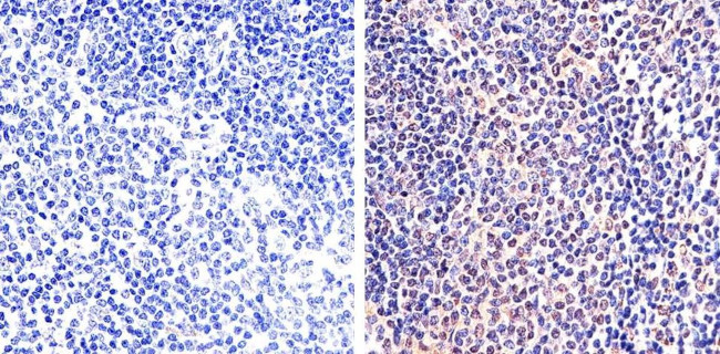 Phospho-STAT5 alpha (Tyr694) Antibody in Immunohistochemistry (Paraffin) (IHC (P))