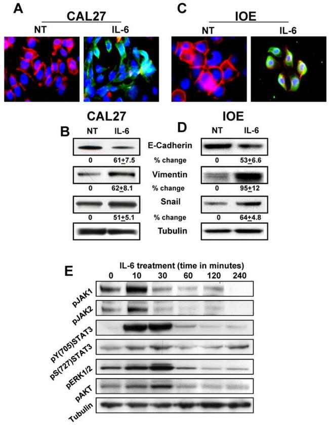 Phospho-JAK1 (Tyr1022, Tyr1023) Antibody in Western Blot (WB)