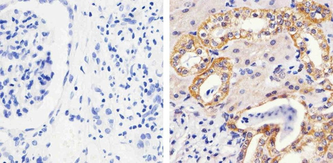 Phospho-MEK1 (Thr292) Antibody in Immunohistochemistry (Paraffin) (IHC (P))