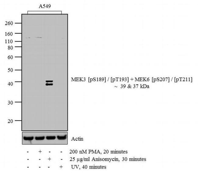 Phospho-MEK3/MEK6 (Ser189, Thr193, Ser207, Thr211) Antibody in Western Blot (WB)