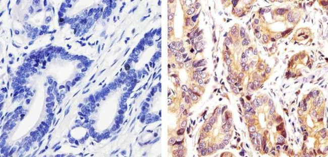 Phospho-c-Kit (Tyr730) Antibody in Immunohistochemistry (Paraffin) (IHC (P))