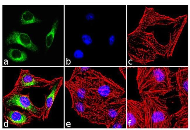 Phospho-HSP25 (Ser86) Antibody