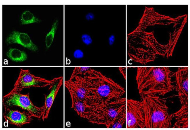 Phospho-HSP25 (Ser86) Antibody in Immunocytochemistry (ICC/IF)