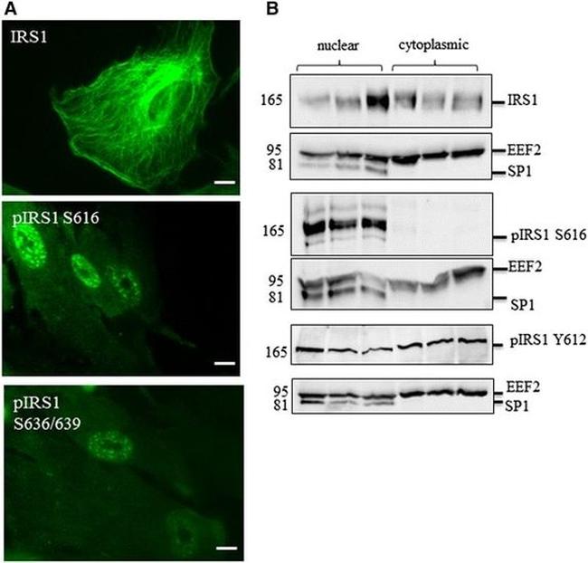 Phospho-IRS1 (Tyr612) Antibody in Western Blot (WB)