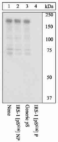 Phospho-IRS1 (Ser616) Antibody in Western Blot (WB)