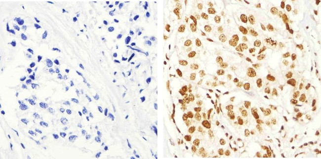 Phospho-IRS1 (Ser616) Antibody in Immunohistochemistry (Paraffin) (IHC (P))