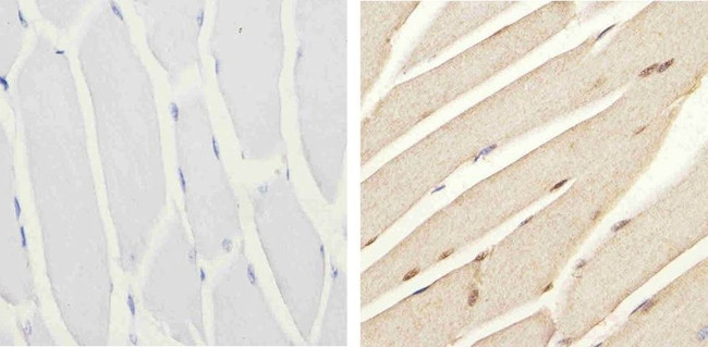 Phospho-IRS1 (Ser616) Antibody in Immunohistochemistry (Paraffin) (IHC (P))