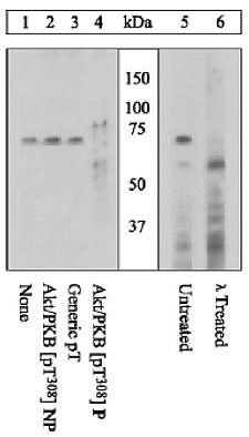 Phospho-AKT1 (Thr308) Antibody in Western Blot (WB)