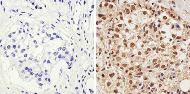 Phospho-AKT1 (Thr308) Antibody in Immunohistochemistry (Paraffin) (IHC (P))