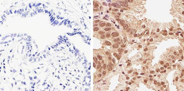 Phospho-AKT1 (Thr308) Antibody in Immunohistochemistry (Paraffin) (IHC (P))