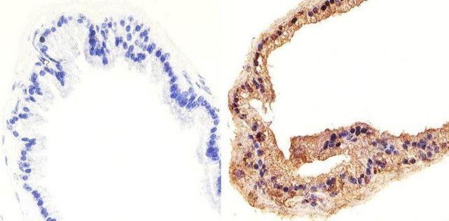 Phospho-AKT1 (Thr308) Antibody in Immunohistochemistry (Paraffin) (IHC (P))