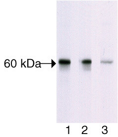 Phospho-AKT1 (Thr308) Antibody in Western Blot (WB)