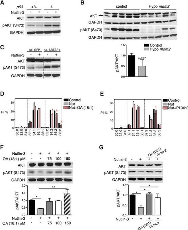 Phospho-AKT1 (Ser473) Antibody in Western Blot (WB)