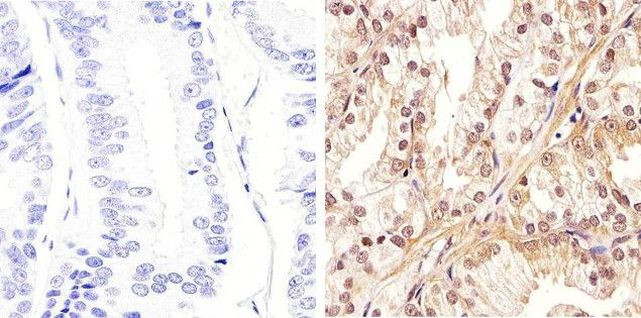 AKT Pan Antibody in Immunohistochemistry (Paraffin) (IHC (P))