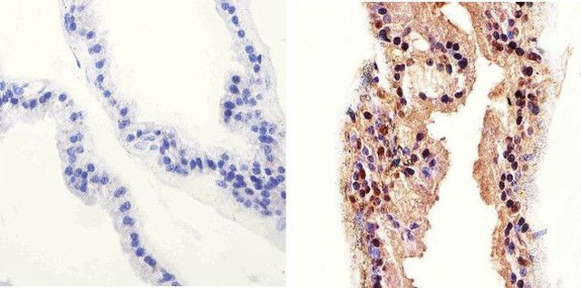 AKT Pan Antibody in Immunohistochemistry (Paraffin) (IHC (P))