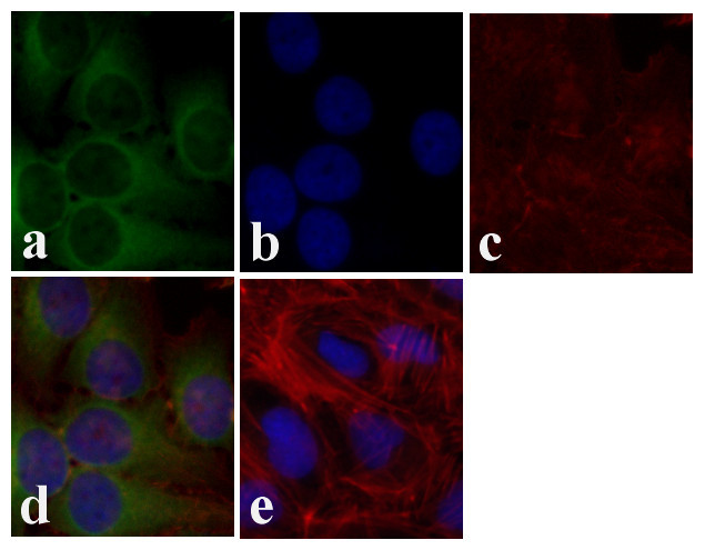 AKT Pan Antibody in Immunocytochemistry (ICC/IF)