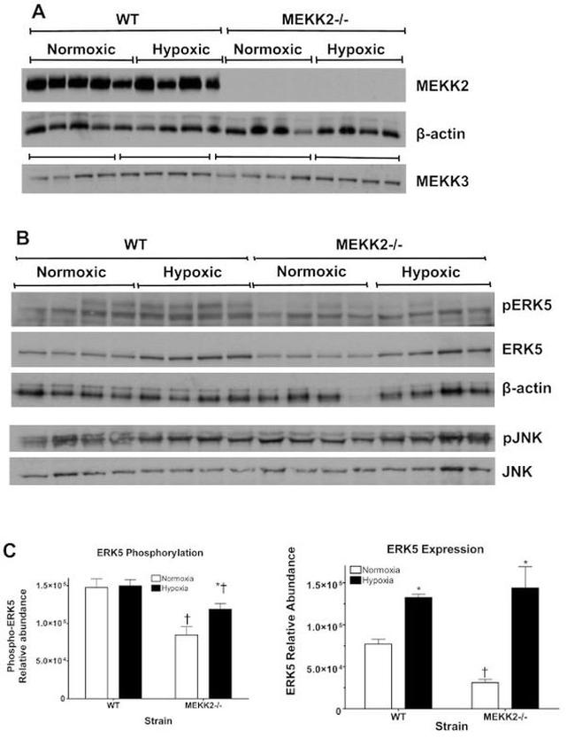 Phospho-ERK5 (Thr218, Tyr220) Antibody in Western Blot (WB)