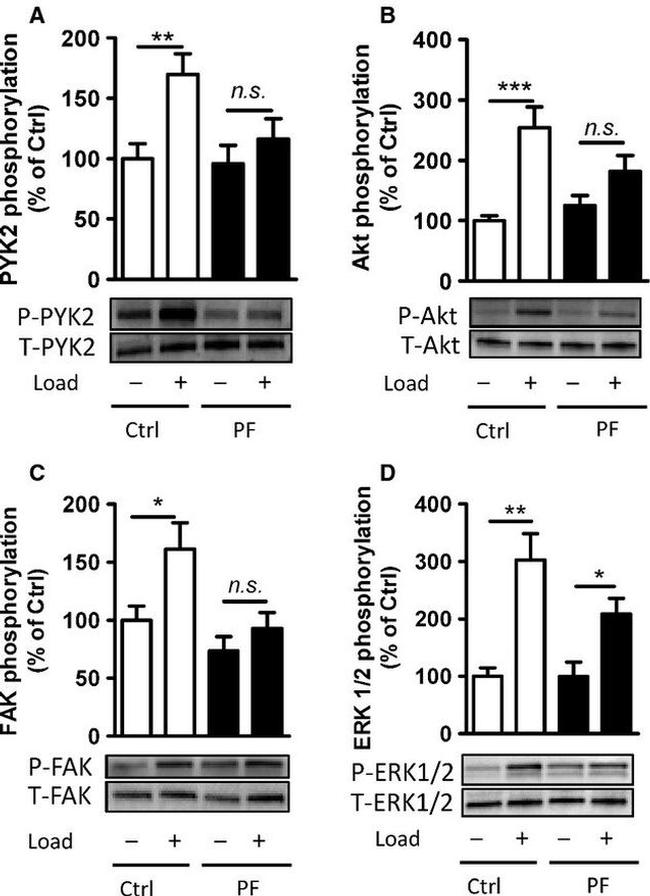 Phospho-PYK2 (Tyr402) Antibody in Western Blot (WB)