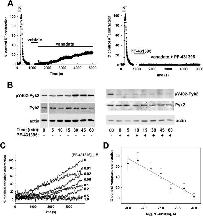 Phospho-PYK2 (Tyr402) Antibody in Western Blot (WB)