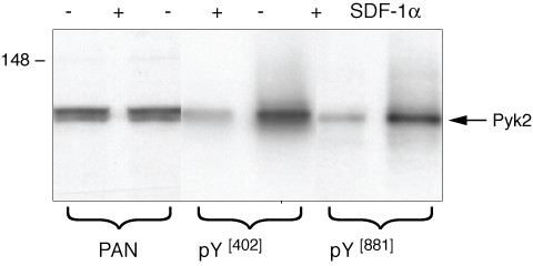 Phospho-PYK2 (Tyr402) Antibody in Western Blot (WB)