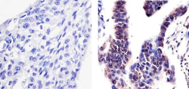 Phospho-PYK2 (Tyr402) Antibody in Immunohistochemistry (Paraffin) (IHC (P))