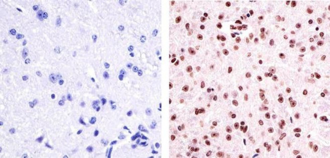 Phospho-PYK2 (Tyr402) Antibody in Immunohistochemistry (Paraffin) (IHC (P))