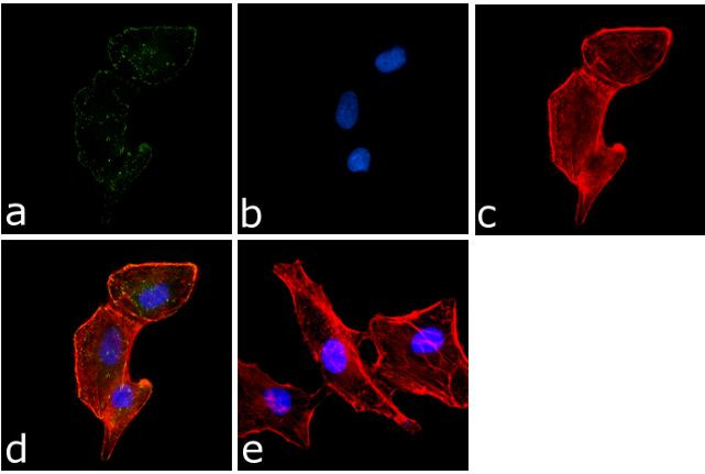 Phospho-PYK2 (Tyr402) Antibody in Immunocytochemistry (ICC/IF)