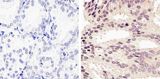 Phospho-AKT1 (Ser473) Antibody in Immunohistochemistry (Paraffin) (IHC (P))