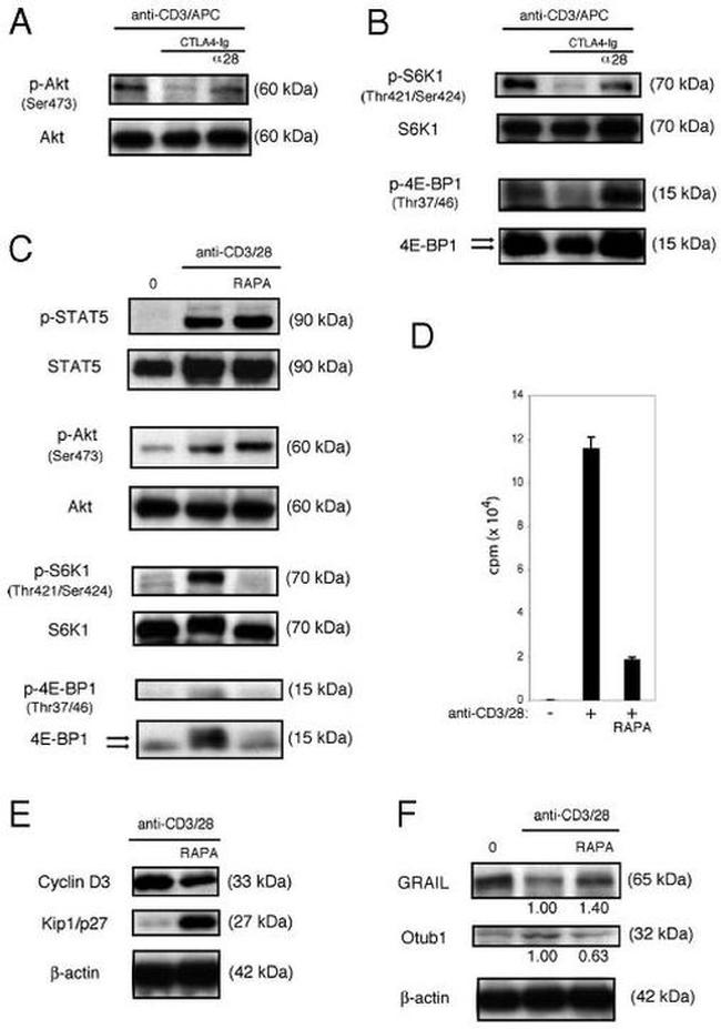 Phospho-AKT1 (Ser473) Antibody in Western Blot (WB)