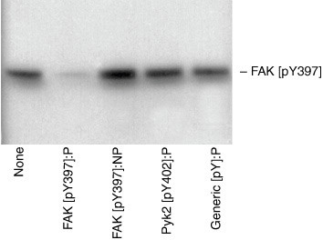 Phospho-FAK (Tyr397) Antibody in Western Blot (WB)