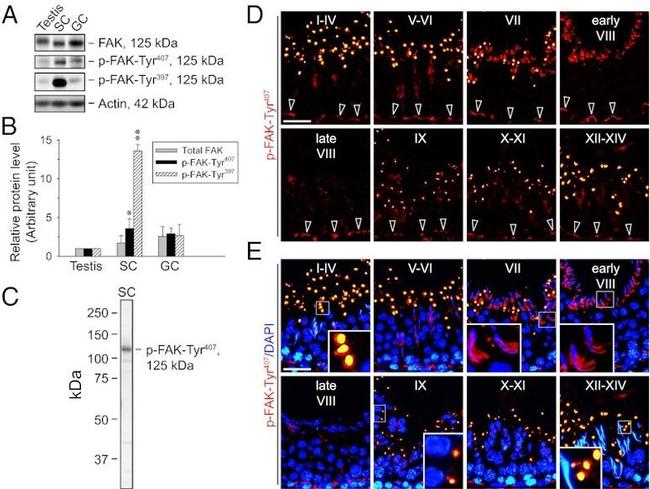 Phospho-FAK (Tyr407) Antibody in Western Blot, Immunohistochemistry (WB, IHC)
