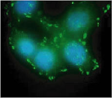 Phospho-FAK (Tyr397) Antibody in Immunocytochemistry (ICC/IF)