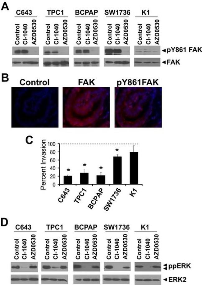 Phospho-FAK (Tyr861) Antibody in Western Blot, Immunocytochemistry, Immunohistochemistry (Paraffin) (WB, ICC/IF, IHC (P))