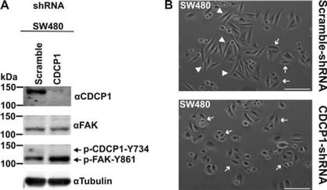 Phospho-FAK (Tyr861) Antibody in Western Blot (WB)