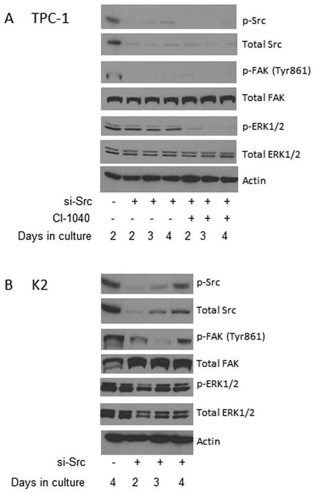 Phospho-FAK (Tyr861) Antibody in Western Blot (WB)