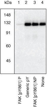 Phospho-FAK (Tyr861) Antibody in Western Blot (WB)