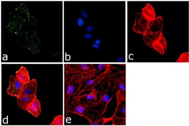 Phospho-FAK (Tyr861) Antibody in Immunocytochemistry (ICC/IF)